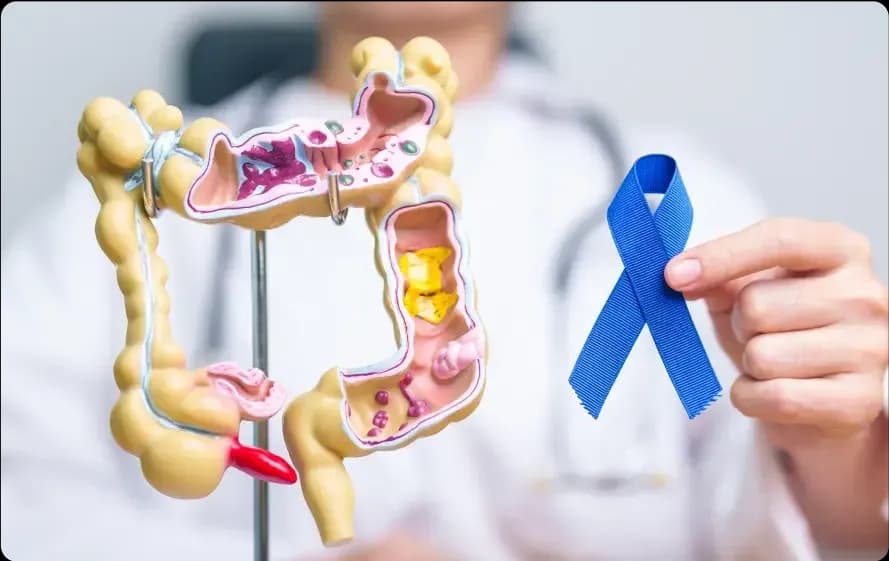 Risk Factors for Prostate Cancer in Pakistan