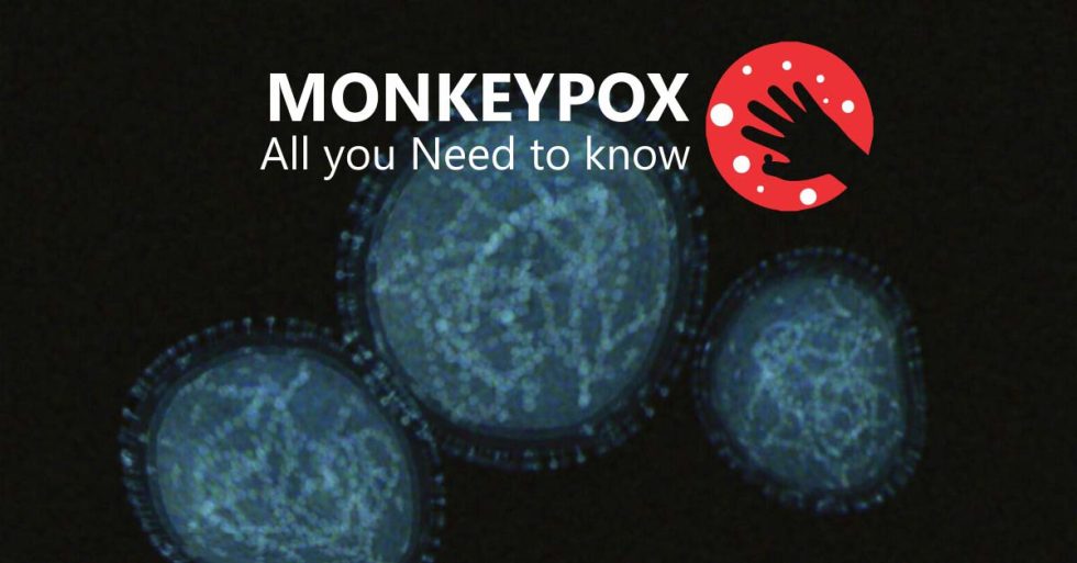 Monkey Pox All You Need To Know Shifa International Hospital