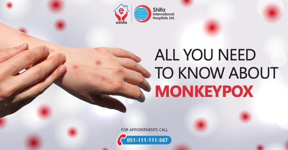 Monkey Pox isn't Monkeying Around! Shifa International Hospital